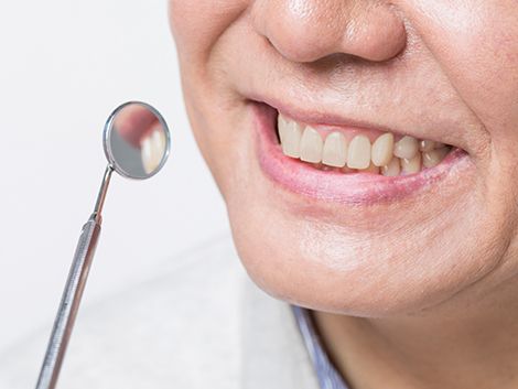 나이가 들면서 법랑질이 얇아지고 상아질이 두꺼워져 어두워지는 치아를 구강 검진 기구로 확인하는 모습